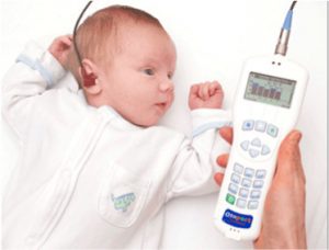 BERA Hearing test on babies