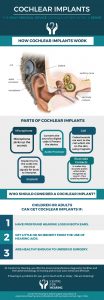 understanding-cochlear-implants