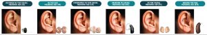 Common Hearing Loss Myths Busted