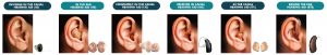Style And Shape Of Hearing Aids