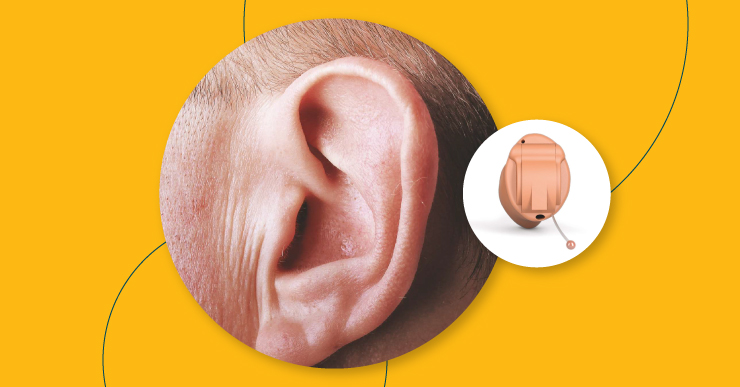 Invisible-in-the-Canal (IIC) Hearing Aids