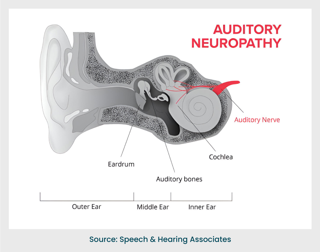 Auditory spectrum