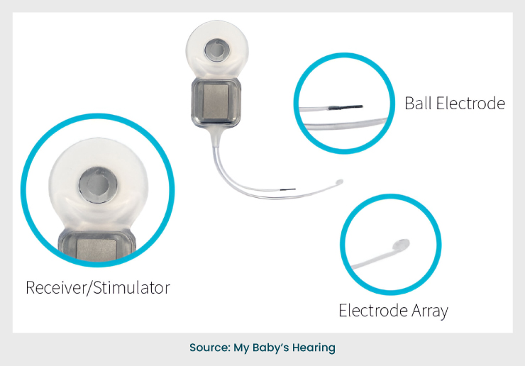 Electrode Array