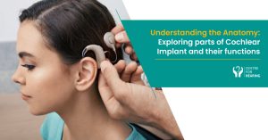 parts of cochlear implant