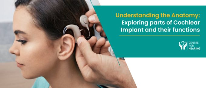 parts of cochlear implant