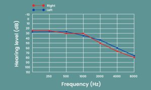 Increased-ambient-sound-detection