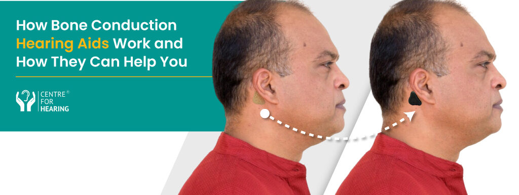 You’ll Never Believe How Bone Conduction Hearing Aids Work! (And How They Can Help You)