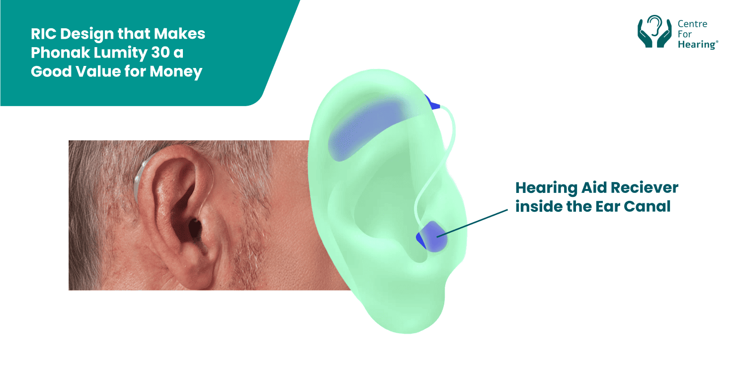 Phonak Lumity 30 a Good Value for Money