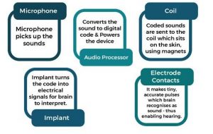 cochlear-implants-part-how-it-works-2