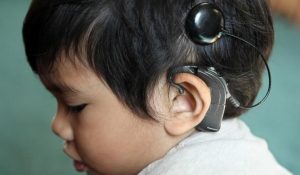 rehabilitation-after-cochlear-implants