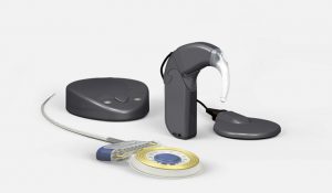 switch-on-cochlear-implants