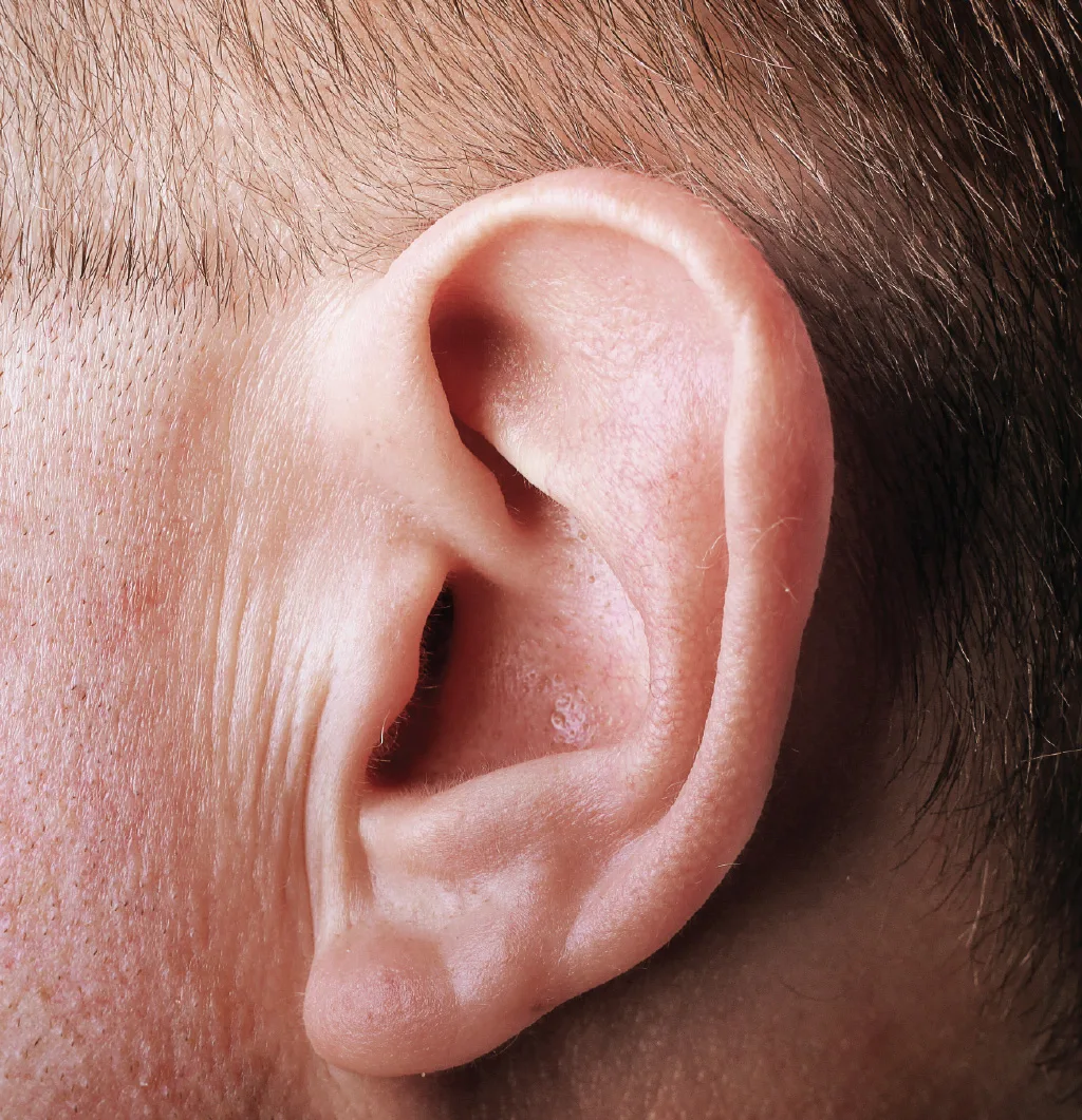 Invisible-in-the-Canal (IIC) on ear