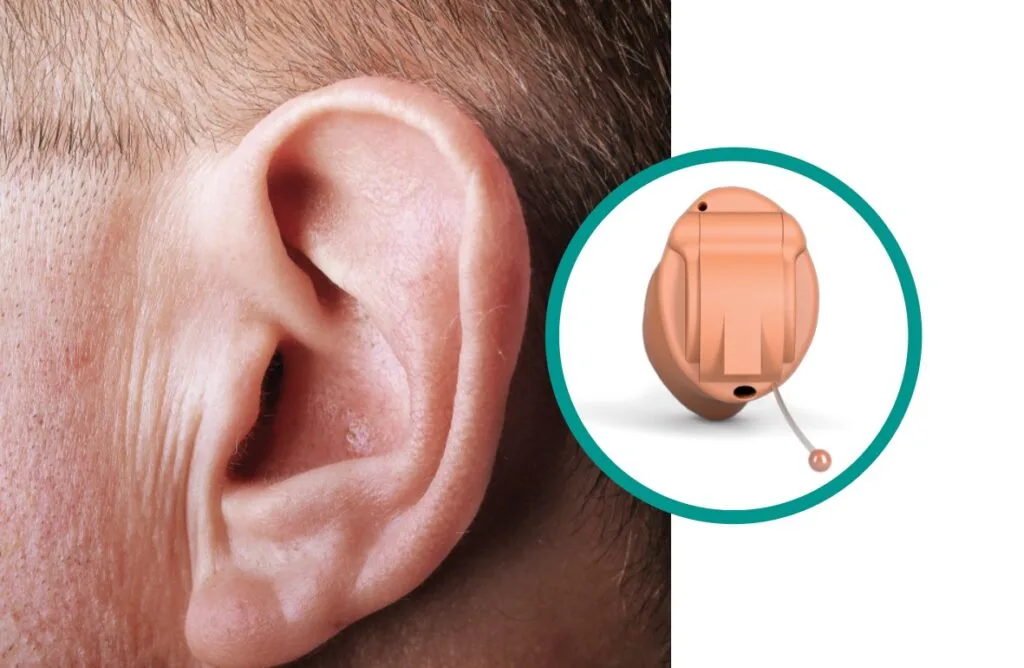Invisible-in-Canal (IIC) Hearing Aids