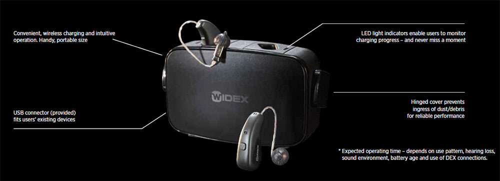 Widex SmartRIC Hearing Aids: Expert Review
