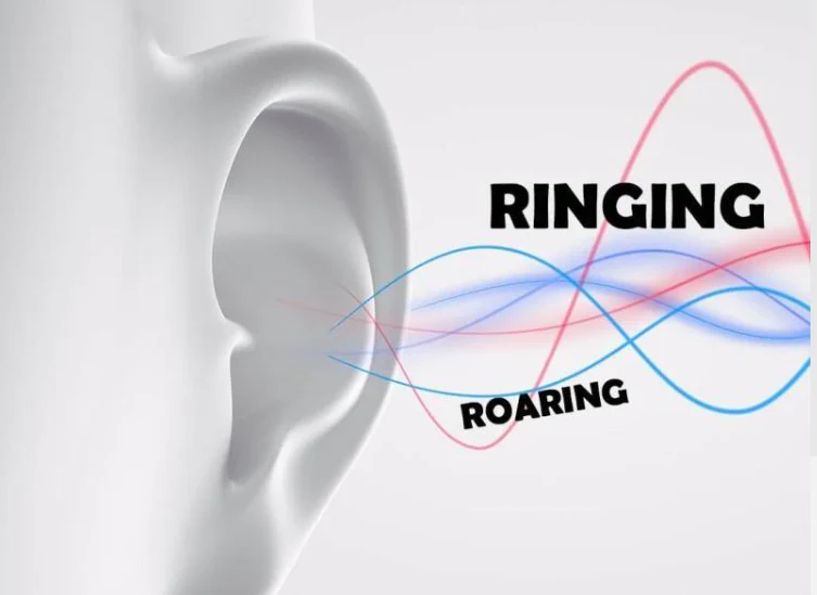 Ringing roaring