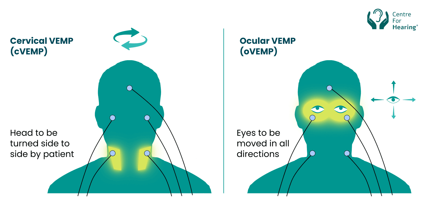Types of VEMP testing