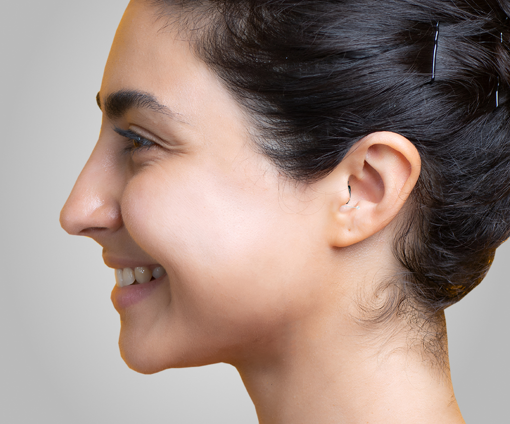 A patient wearing an RIC model