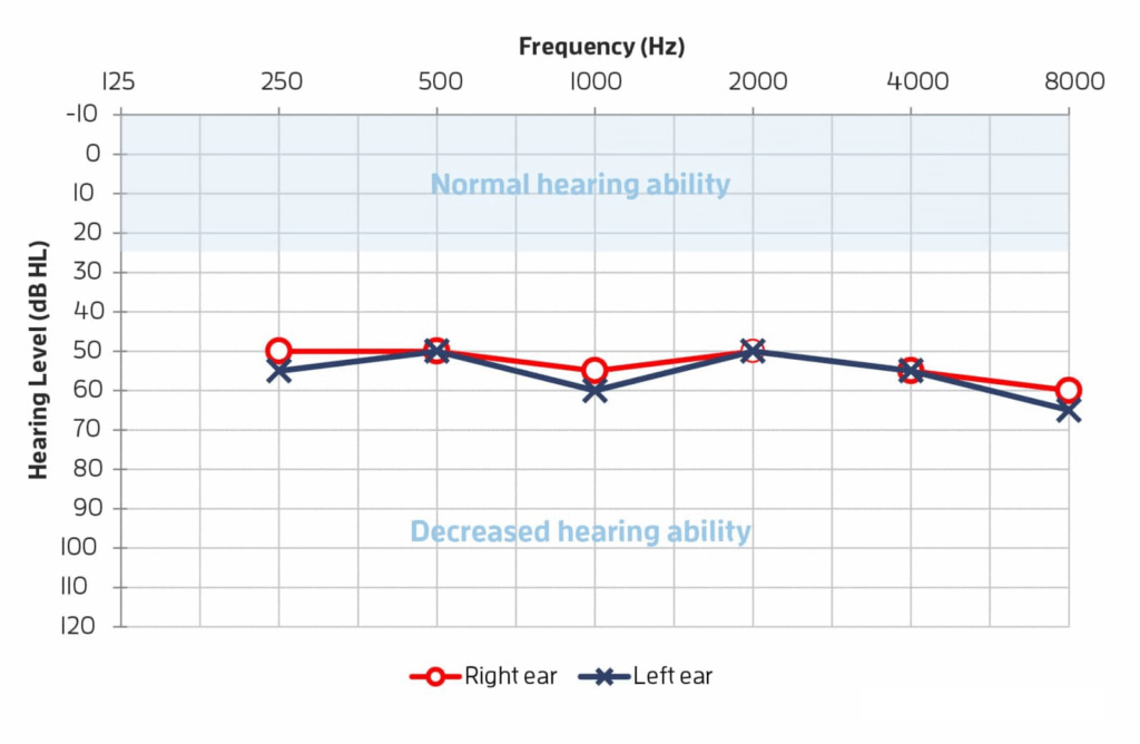 Graph of hearing levels