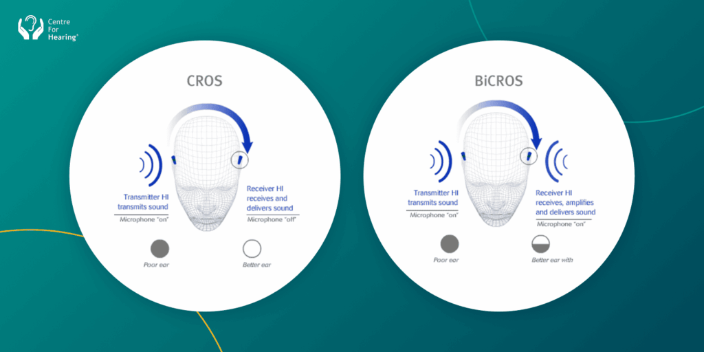 Single-Sided Hearing Loss_ CROS and BiCROS Hearing Aids