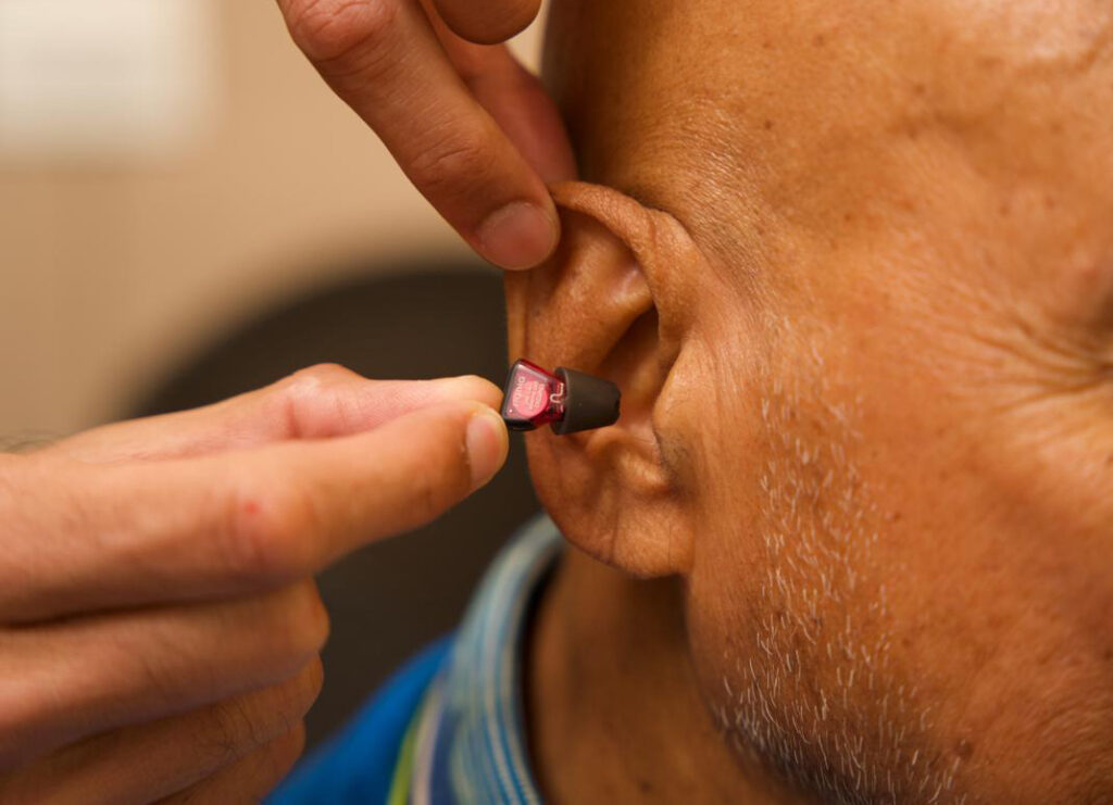 Invisible hearing aid fitting