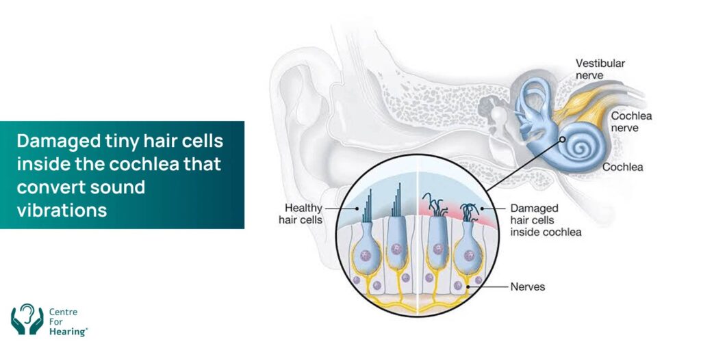 Why medicine can't reverse most hearing loss