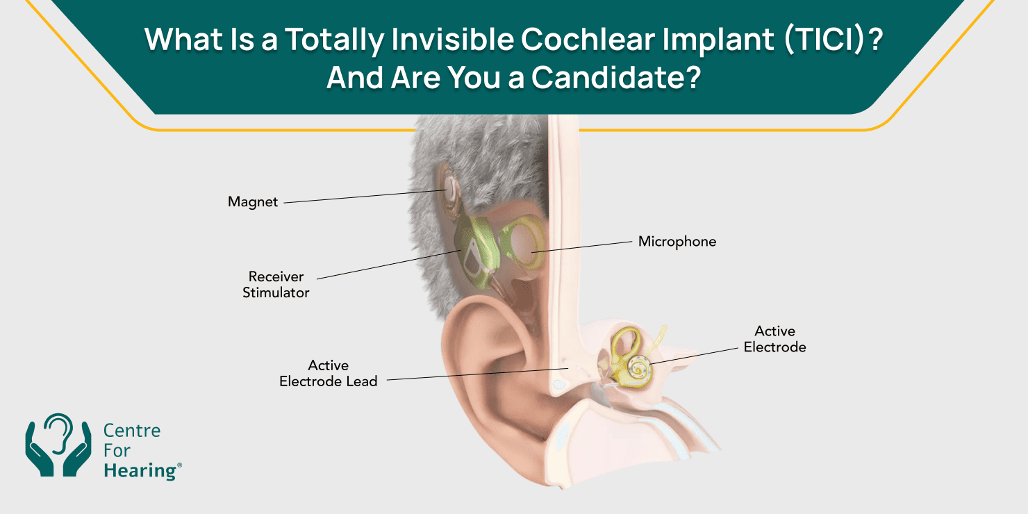 Totally Invisible Cochlear Implant_Featured Image